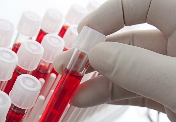 analisi del sangue dopo aver bevuto alcolici